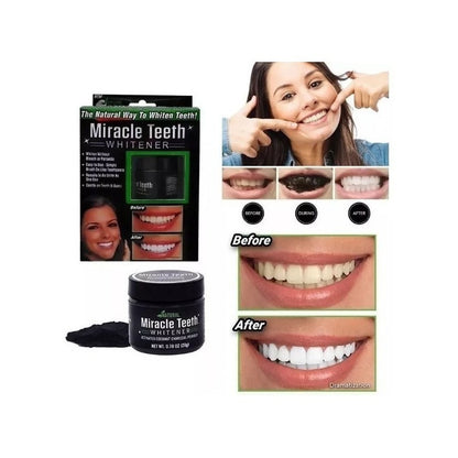 Blanqueador Miracle De Dientes Teeth Whitening Teeth Natural